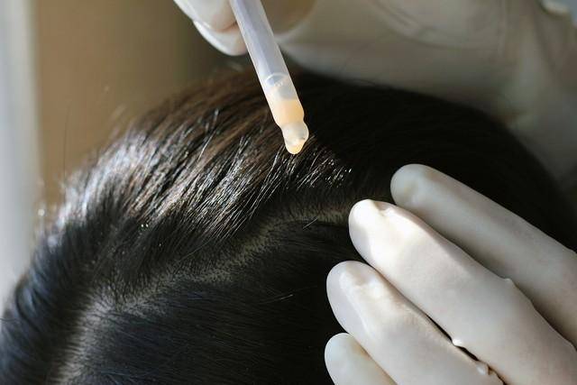 美联储或在10月进行最后加息护发素用多了会掉头发吗？