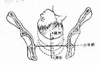 股骨长是什么意思？