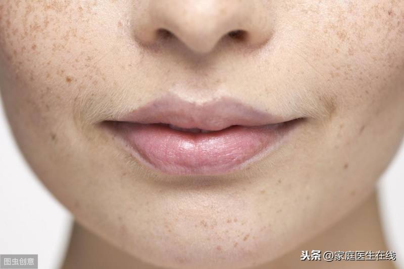 江中牌祛斑胶囊真的祛黄褐斑吗？
