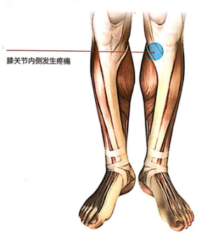 膝关节内侧疼痛的原因和治疗方法，膝关节内侧疼但不知道什么原因？